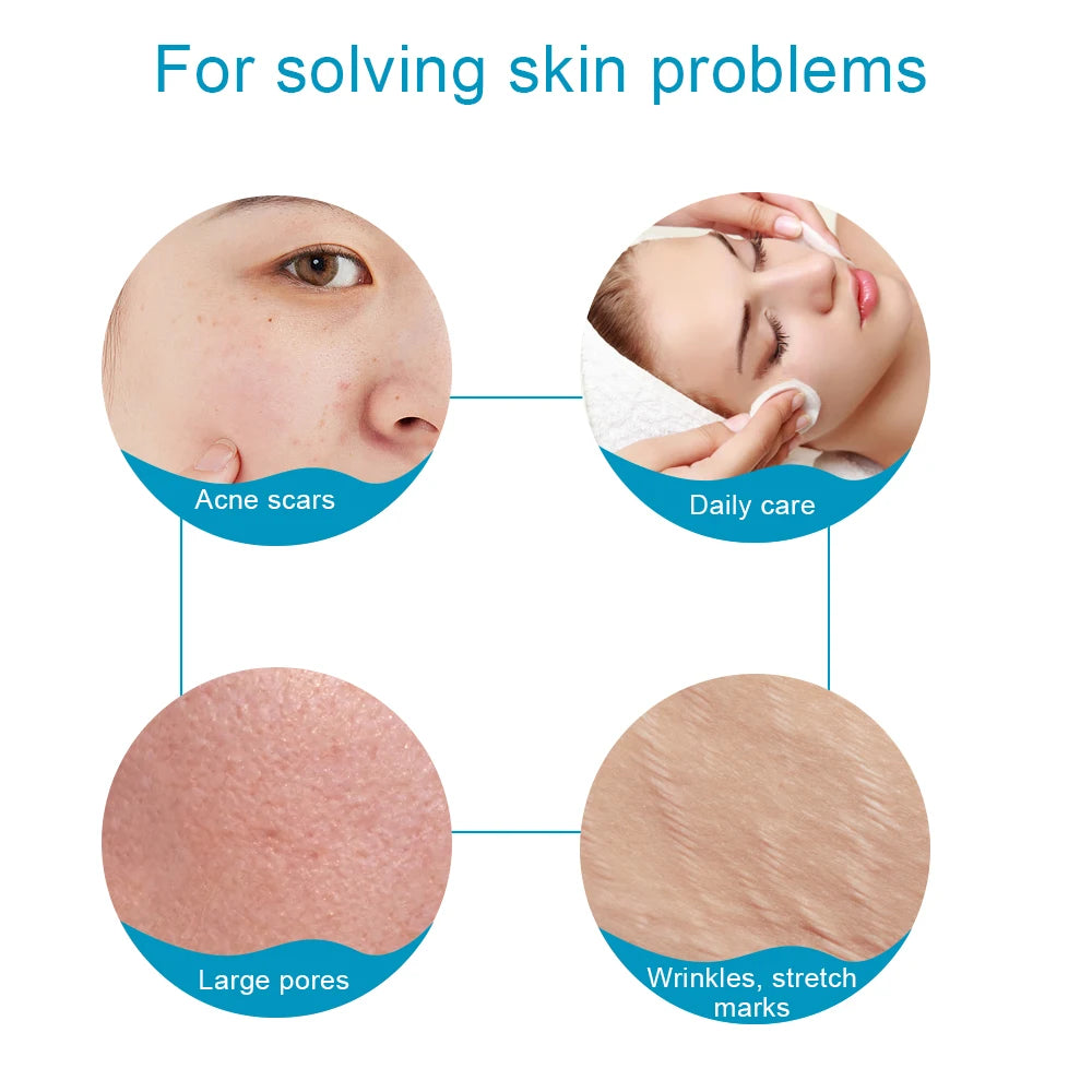 Skin Facial Care Microneedle Derma Roller