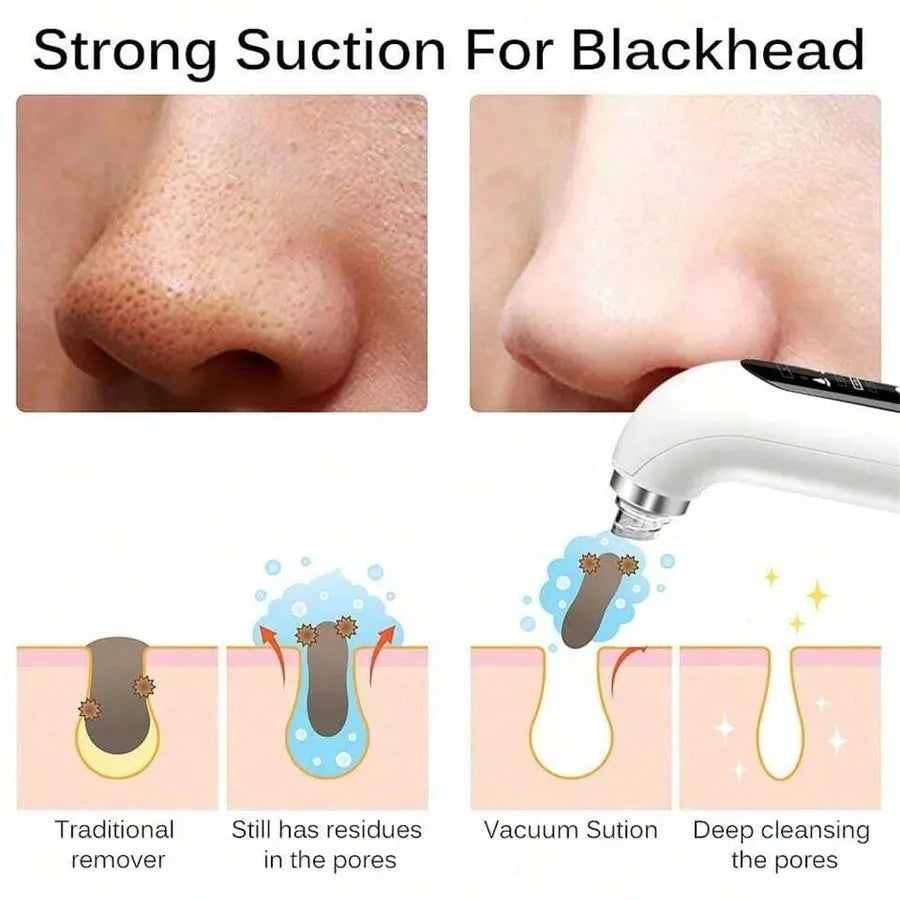 Face Beauty Pore Vacuum Facial Cleaner